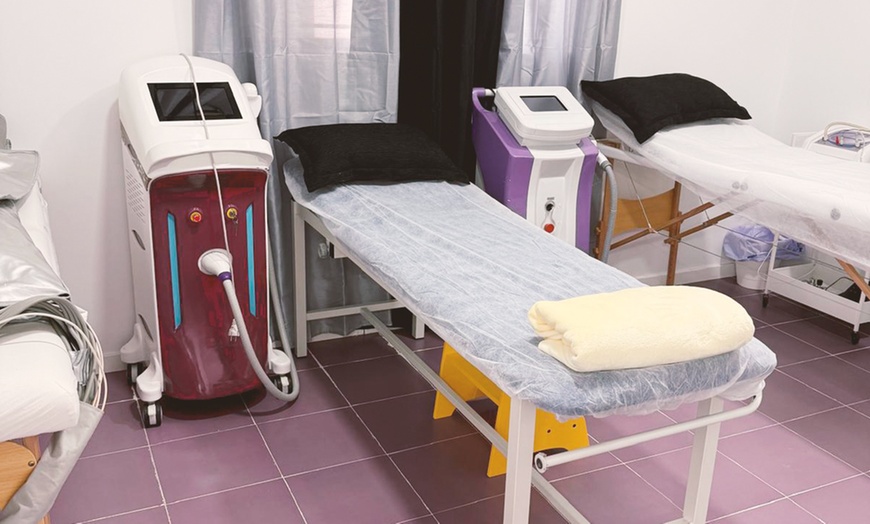 Image 7: Tratamiento de rejuvenecimiento facial con 10 o 20 hilos tensores PDO