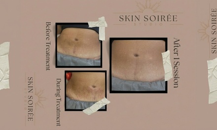Intro Tattoo Session (Small Area - approximately 2x2 inches) - Skin Soiree Studio