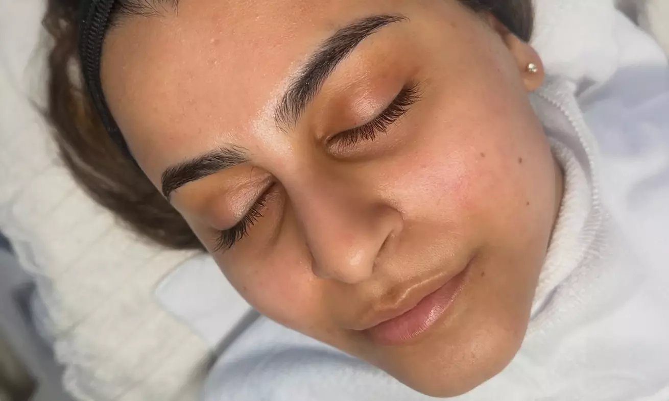 Enhance Your Natural Beauty with Dermal Filler Treatments