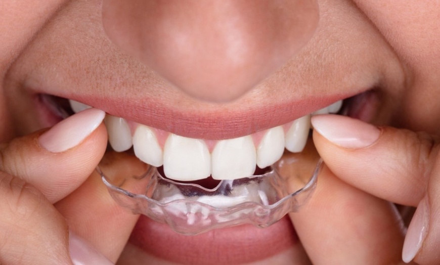 Image 2: Clear Aligners Or Invisalign With Dental Exam, X-Ray And Cleaning
