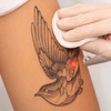 Image 1: Three Laser Tattoo Removal Sessions on an Area (1,3 or 6 Inches)