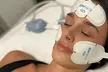 1 o 3 sesiones de estimulación electromagnética facial con efecto lifting para 1 persona; ahorra hasta un 70% - Second Medium