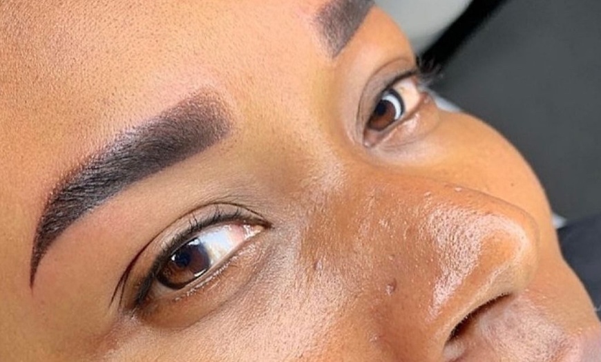 Image 3: Permanent mooie oogopslag: PMU behandeling naar keuze
