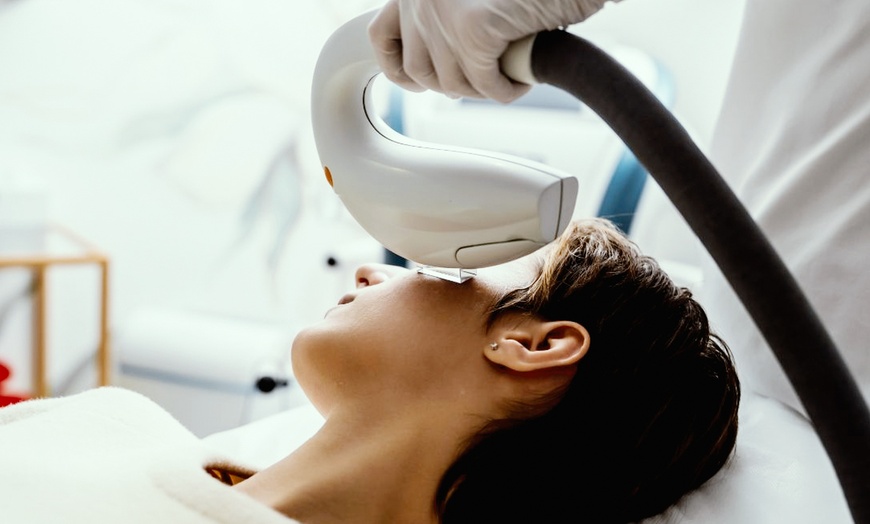 Image 1: Revitalize with One IPL with or Without RF Treatment For Dry Eye 