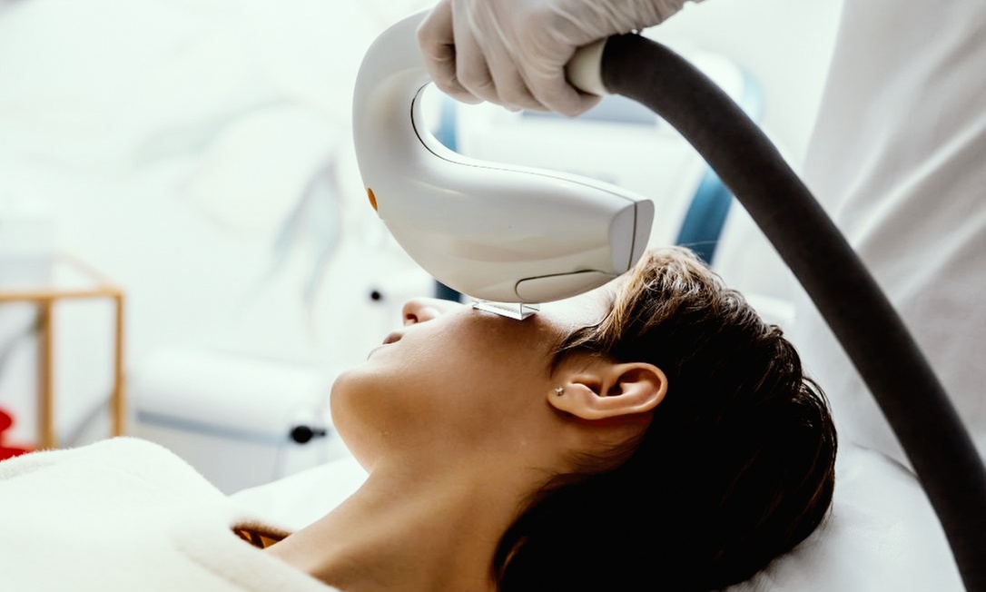 Revitalize with One IPL with or Without RF Treatment For Dry Eye