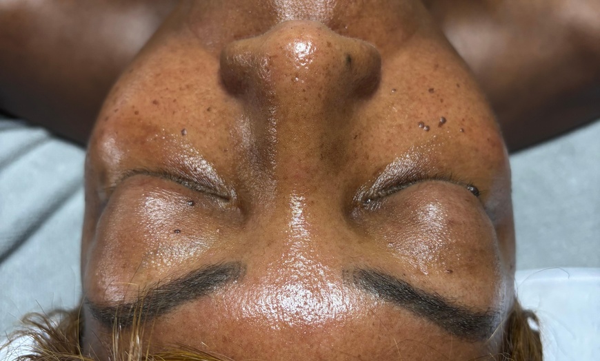 Image 8: Up to 50% Off on Deep Cleansing Facial