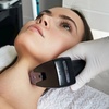 Image 2: Hydrafacial or Skin Tighetining Session with Morpheus 8 Microneedling