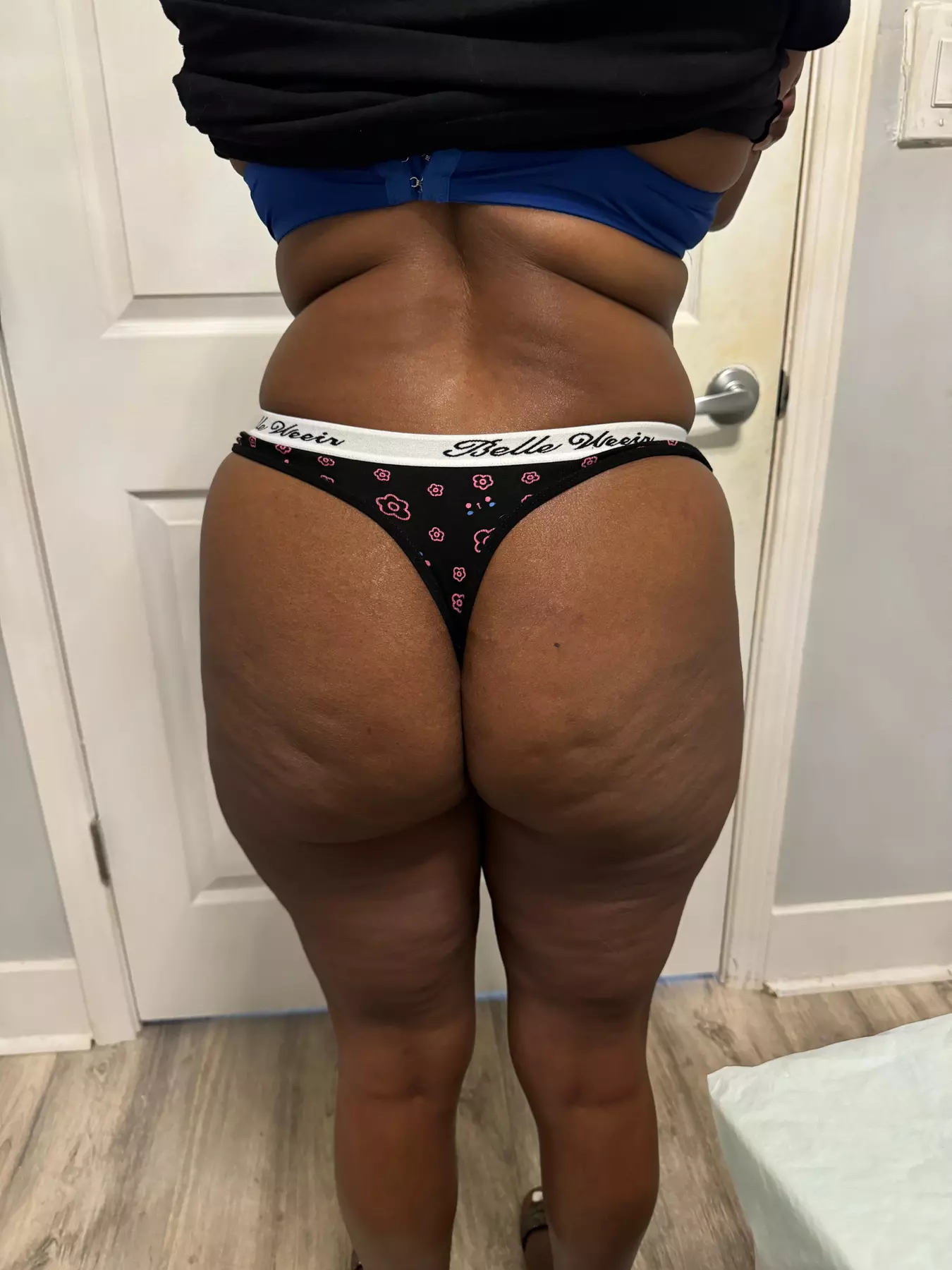 Non-Invasive Laser Lipo: Choose from Four or Six Sessions