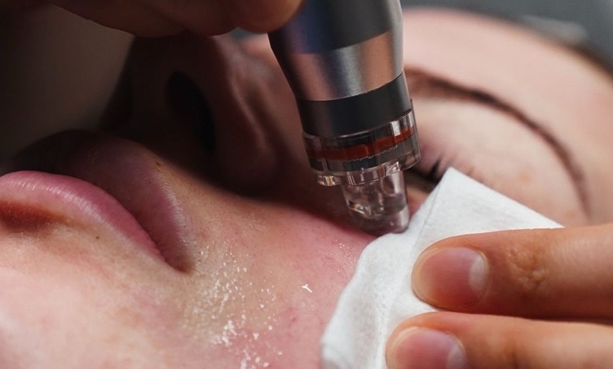Image 1: Experience One or Two Sessions of Hydra Facial and Unleash Your Glow