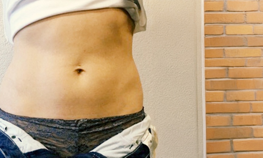 Image 1: Kryotherapie an 1 Zone nach Wahl oder Bauch, Oberschenkeln und Armen