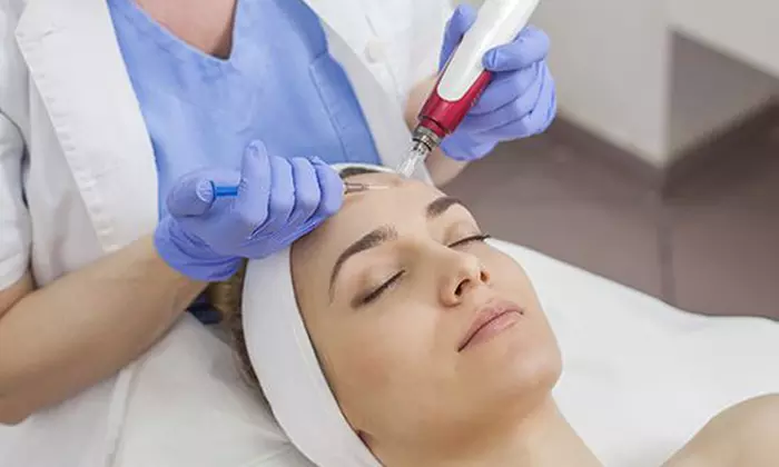 Mesolift mit Diamant-Mikrodermabrasion