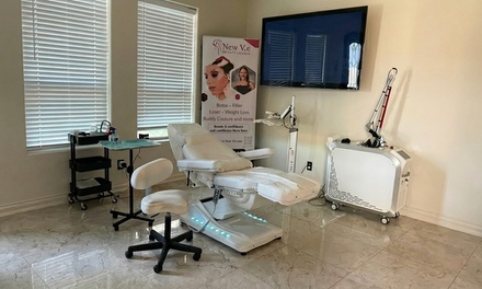 1 Session of Medical Grade Chemical Peel - New me Beauty