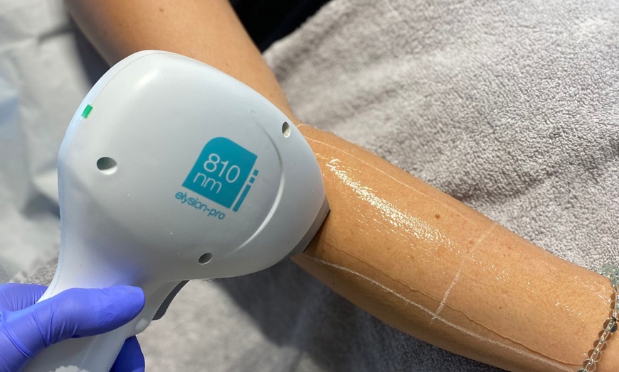 Image 4: Up to 88% Off on Laser Hair Removal at See You Laser