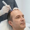 Image 2: PRP Hair Growth Therapy for Stronger, Thicker Hair
