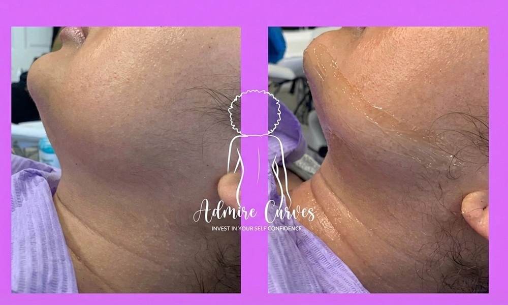 Birthday Body Sculpting Packages for Waist, Tummy & Thigh Body