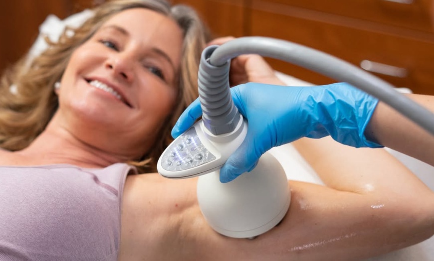 Image 3: One or Three Venus Legacy RF Skin Tightening Treatments