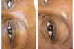 One Micropigmentation Treatment of Any Style w/ Optional Touch-Up (Up to 65% Off) - Second Medium