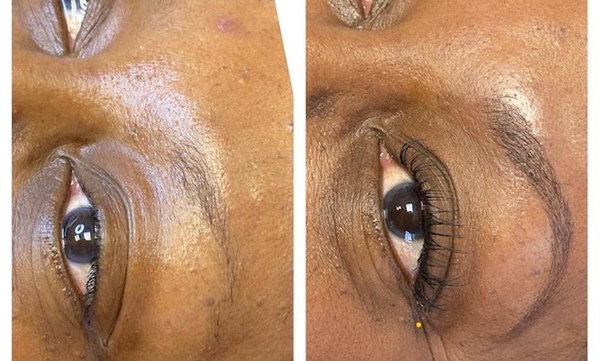 Image 4: One Micropigmentation Treatment of Any Style w/ Optional Touch-Up