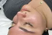 One, Two or Three Hydrafacial, Red Light Therapy and Much More at Intuitive Spa (Up to 62% Off) - Second Medium