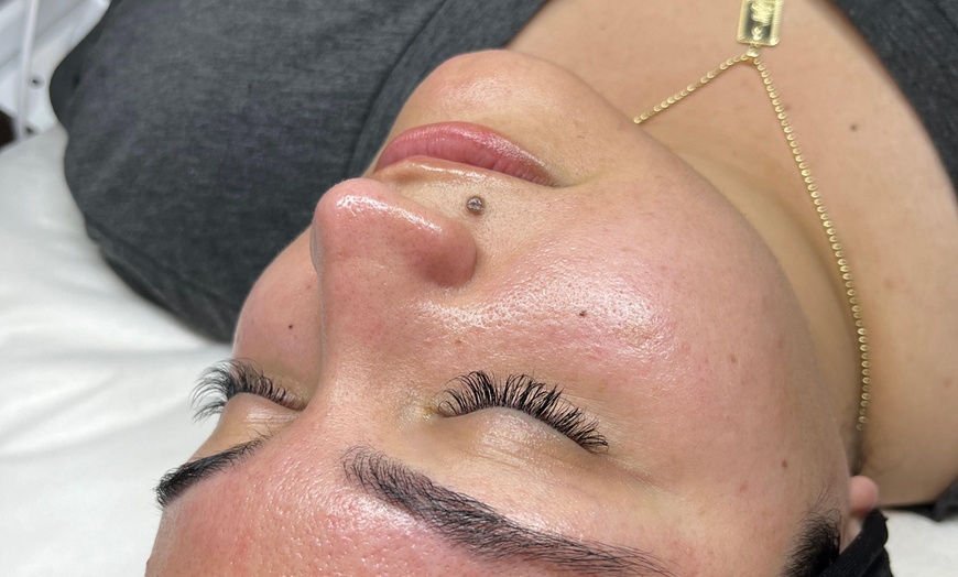 Image 6: One, Two or Three Hydrafacial, Red Light Therapy and Much More