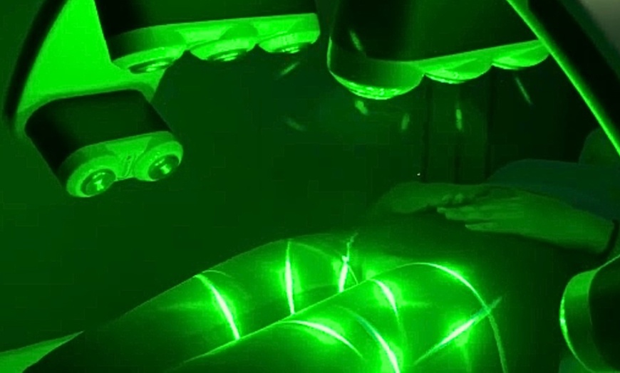Image 2: Tone with One, Four, Eight, Twelve or Sixteen of Emerald Laser Package