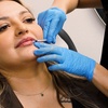 Image 4: 39% Off Smooth Lines with Juvederm Ultra XC