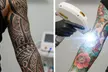 Say Goodbye to Unwanted Ink: 3 Laser Tattoo Removal Sessions for Small, Medium, or Large Areas (Up to 76%Off) - Image 2