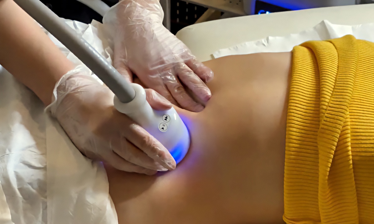 Cryoesthétique sur zone au choix avec Cocoonin' Paris