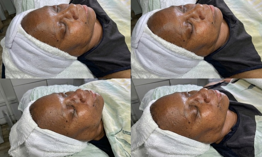 Image 2: Glow Your Skin with 1, 2, or 3 45 Minute Glow Facial Session Package