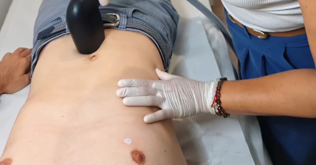 Sesiones de depilación láser de diodo en Palma de Mallorca