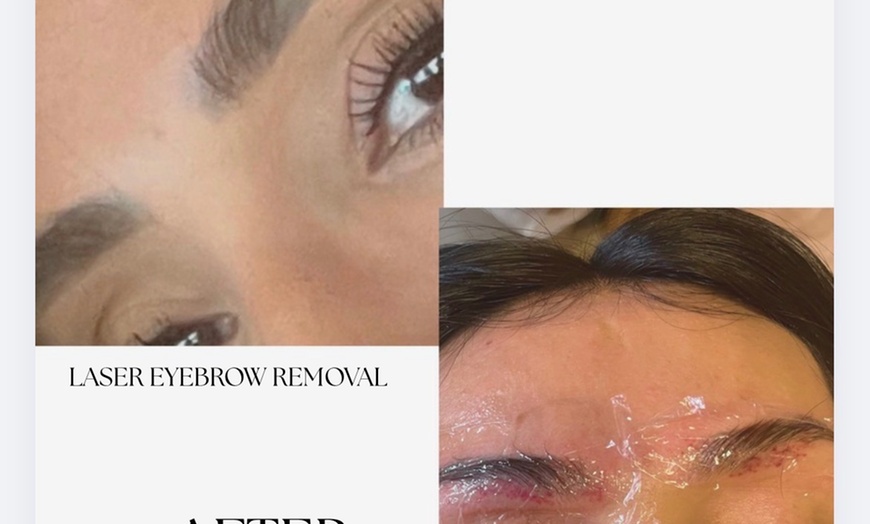 Image 6: Microblading Sessions at Skinz.Beauty.Studio