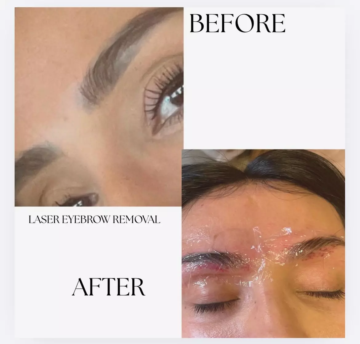 Microblading Sessions at Skinz.Beauty.Studio