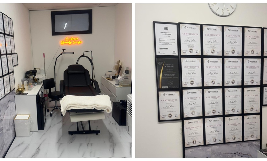 Image 2: Up to 54% Off on Vampire Facelift at Embraces Beauty Lounge