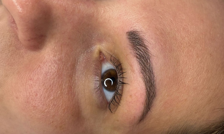 Image 5: Up to 58% Off on Injection - Dermal Filler at Ana Medical