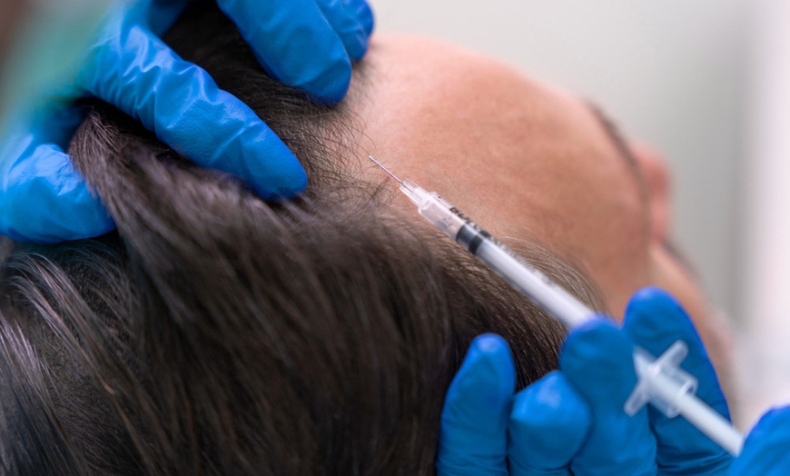 Image 1: Revitalize with One or Three PRP Hair or Skin Sessions + Consultation