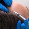 Image 1: Revitalize with One or Three PRP Hair or Skin Sessions + Consultation