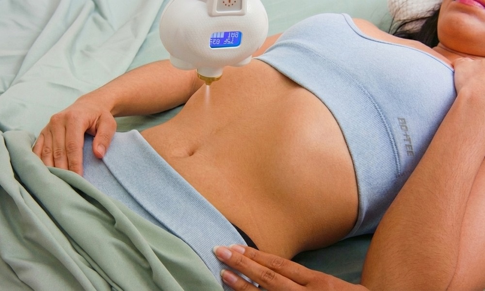 Freeze Stubborn Fat, Reveal Your Shape with CryoSlim Fat Freezing