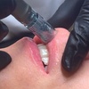 Image 1: Sesión de rehidratación de labios con dermapen y vitaminas para 1 
