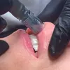 Image 1: Sesión de rehidratación de labios con dermapen y vitaminas para 1 