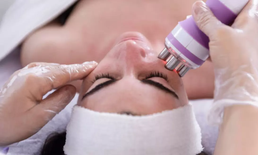 Radiofrecuencia facial, cuello y escote con serum y masaje Kobido