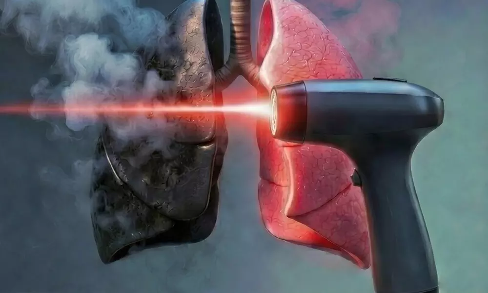 AcuLaser Therapy: A Painless, 30-Minute Low-Level Laser Session to Help Quit Vaping & Smoking (Up to 33% Off) - Primary Image