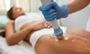 Reshape with (30 min) Cellulite Treatment using ShockWave - 6, or 12 pack - Up to 72% Off