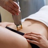Image 2: 6 Laser Hair Removal on Small, Medium, Large, XLarge/2 Small Areas 