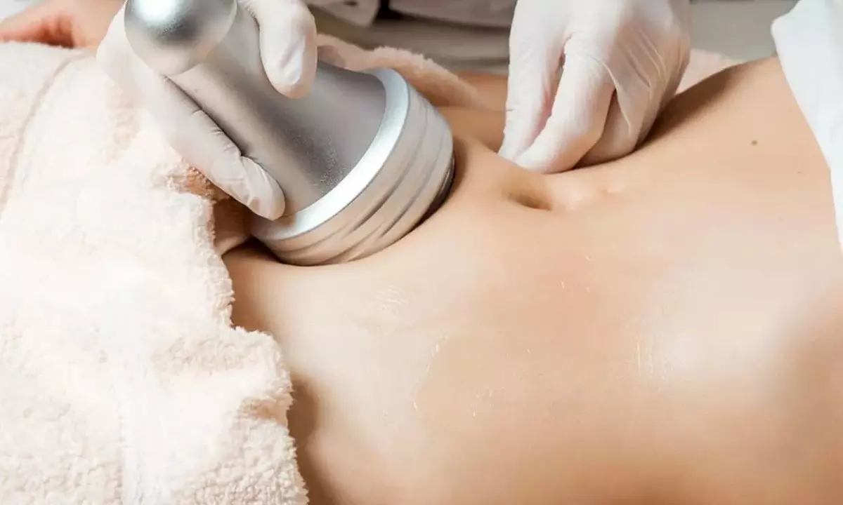 Up to 62% Off on Cavitation at Curvy Med Spa - Primary Image