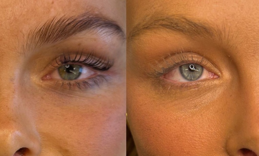 Image 2: Zahnschmuck mit Swarovski®-Kristallen, Lash- oder Brow-Lifting + Farbe