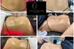 Up to 56% Off on Lymphatic Drainage at The House Of Body sculpting + Free Belly Wrap - Second Medium