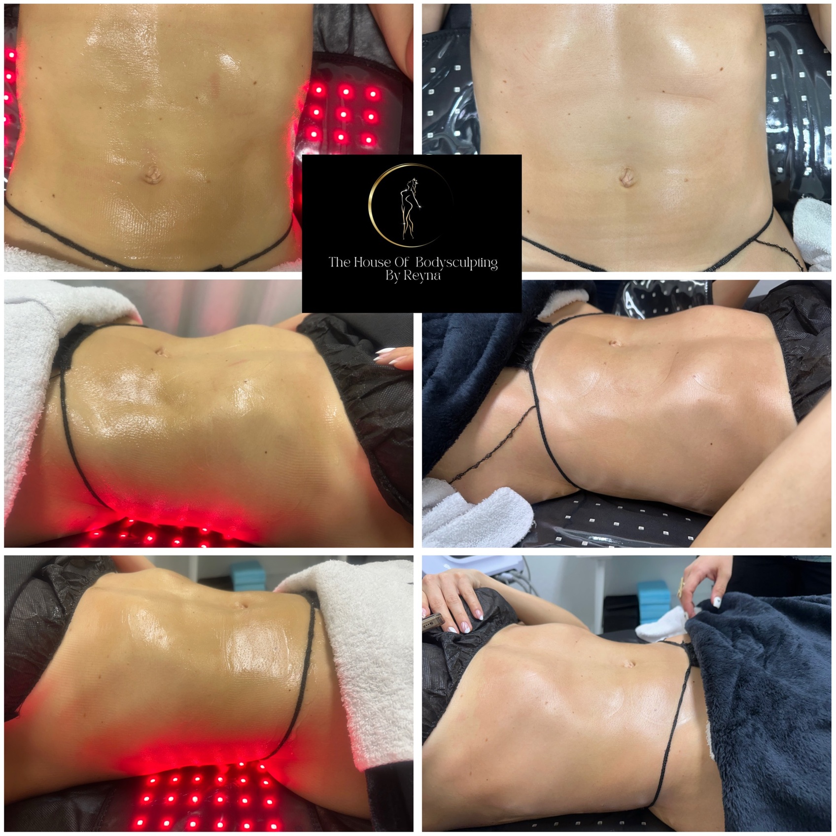 Up to 51% Off on Lymphatic Drainage Massage 