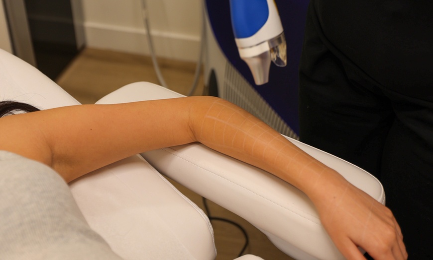 Image 1: Six Laser Hair-Removal Sessions on One Small, Medium, or Large Area