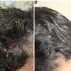 Image 2: Dermclar Method Hair Loss prevention and Neck Massage