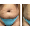 Image 2: 30 or 60-Min Brazilian Lymphatic, Body Wrap, Wood Therapy, & More